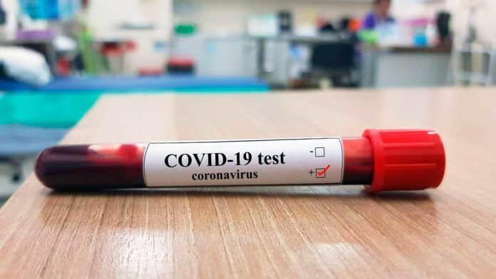 Muestra de sangre positivo en Covid-19