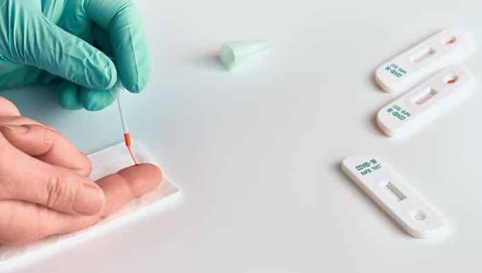 Kit Elisa: test serológico que detecta anticuerpos