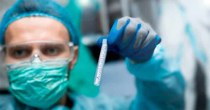 Un técnico en el laboratorio examina el virus de la viruela del mono (monkeypox) en un tubo de ensayo