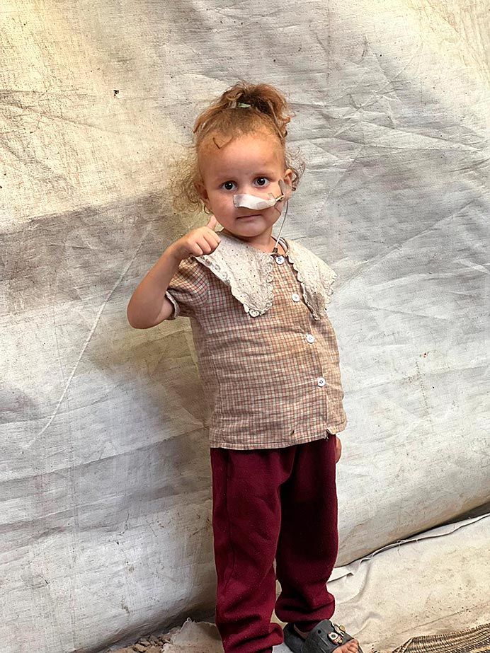 Gaza, el algodón que nos desnuda: cuando la compasión se agota, la humanidad también 1 Hana, de 4 años, tiene desnutrición severa. Ella es una de las niñas por las que Hope Palestina está luchando para que pueda ser evacuada a Andorra.